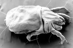 The problem of dust mites in bedding